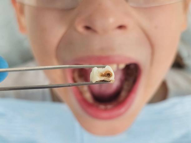 Best Tooth Pain Emergency Relief  in Black Jack, MO